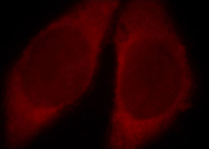 Immunofluorescent analysis of Hela cells, using CAT antibody Catalog No:108885 at 1:25 dilution and Rhodamine-labeled goat anti-rabbit IgG (red).