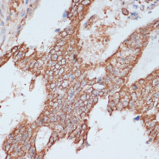 Immunohistochemistry - ACAT1 Polyclonal Antibody 