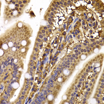 Immunohistochemistry - CLASP1 Polyclonal Antibody 