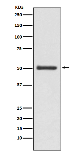 Western blot analysis of LOXL2 expression in MCF7 cell lysate.