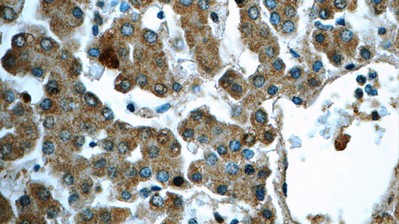 Immunohistochemistry of paraffin-embedded human liver tissue slide using Catalog No:111453(HPS4 Antibody) at dilution of 1:50