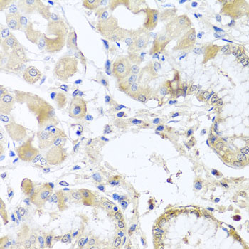 Immunohistochemistry - RPL36 Polyclonal Antibody 