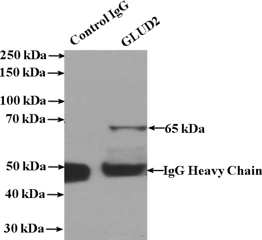 IP Result of anti-GLUD2 (IP:Catalog No:111075, 4ug; Detection:Catalog No:111075 1:1000) with mouse liver tissue lysate 4000ug.