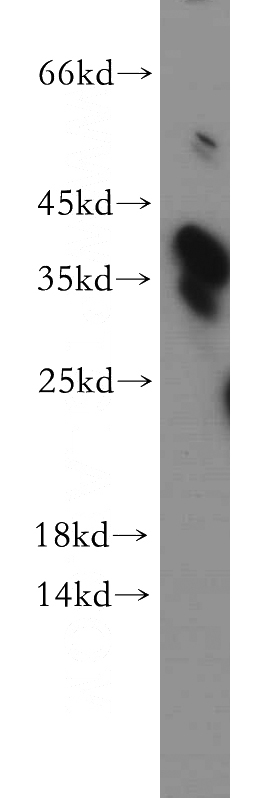 human testis tissue were subjected to SDS PAGE followed by western blot with Catalog No:114653(RHBDD1 antibody) at dilution of 1:300