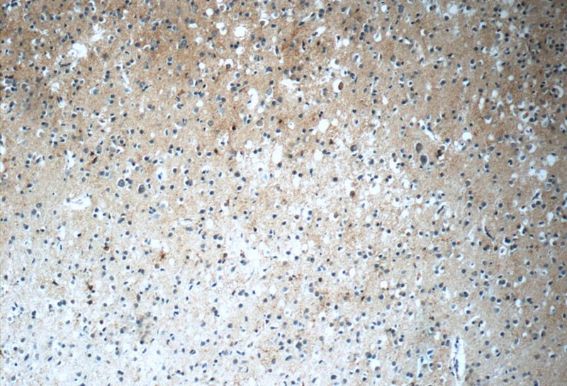 Immunohistochemistry of paraffin-embedded human brain tissue slide using Catalog No:115472(SNX17 Antibody) at dilution of 1:50 (under 10x lens)