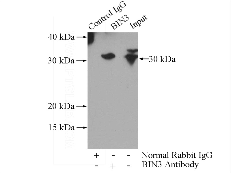 IP Result of anti-BIN3 (IP:Catalog No:117148, 4ug; Detection:Catalog No:117148 1:300) with K-562 cells lysate 3200ug.