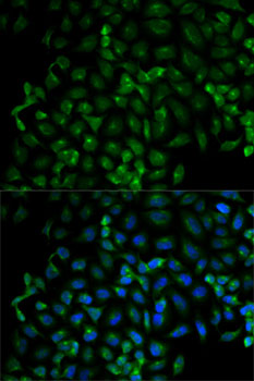 Immunofluorescence - Beta-TRCP Polyclonal Antibody 