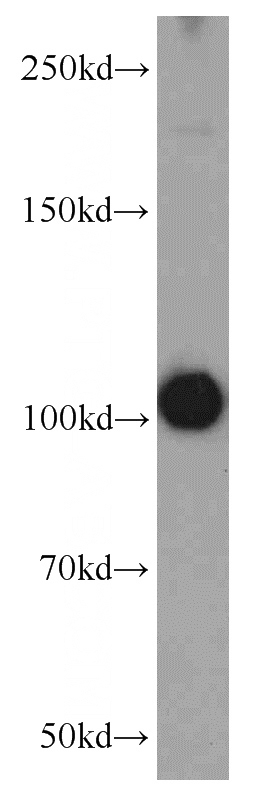 mouse brain tissue were subjected to SDS PAGE followed by western blot with Catalog No:113659(PDE2A antibody) at dilution of 1:1000