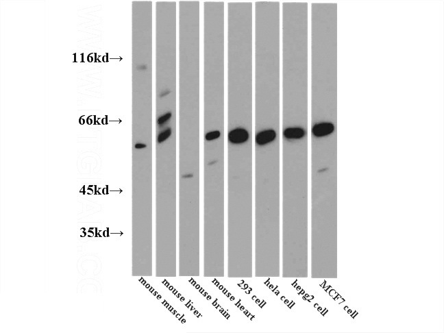 WB results of Catalog No:113856.