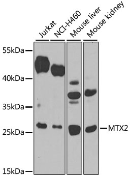 Western blot - MTX2 Polyclonal Antibody 