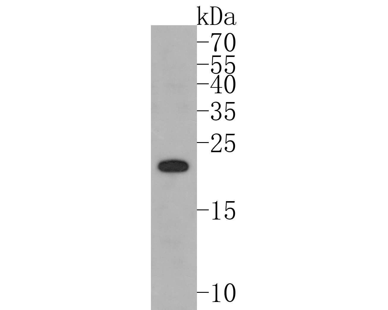 Fig1:; Western blot analysis of PMP22 on PC-12 cell lysates. Proteins were transferred to a PVDF membrane and blocked with 5% BSA in PBS for 1 hour at room temperature. The primary antibody ( 1/500) was used in 5% BSA at room temperature for 2 hours. Goat Anti-Rabbit IgG - HRP Secondary Antibody (HA1001) at 1:5,000 dilution was used for 1 hour at room temperature.