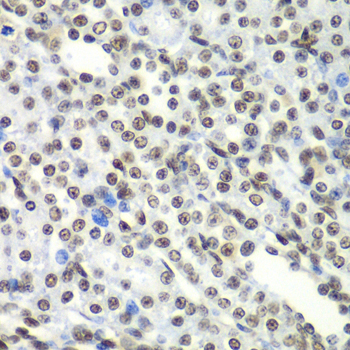 Immunohistochemistry - SF3B2 Polyclonal Antibody 
