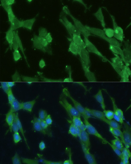 Immunofluorescence - GPI Polyclonal Antibody 