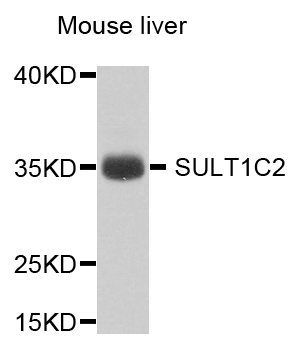 Western blot - SULT1C2 Polyclonal Antibody 
