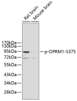 Western blot - Phospho-OPRM1-S375 pAb 