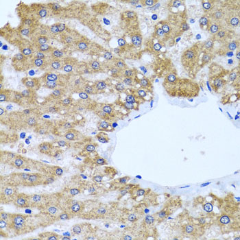 Immunohistochemistry - CCM2 Polyclonal Antibody 