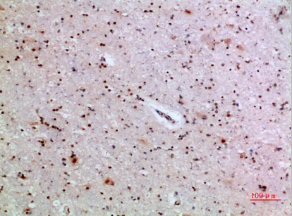 Fig1:; Immunohistochemical analysis of paraffin-embedded human-brain, antibody was diluted at 1:200