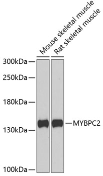 Western blot - MYBPC2 Polyclonal Antibody 