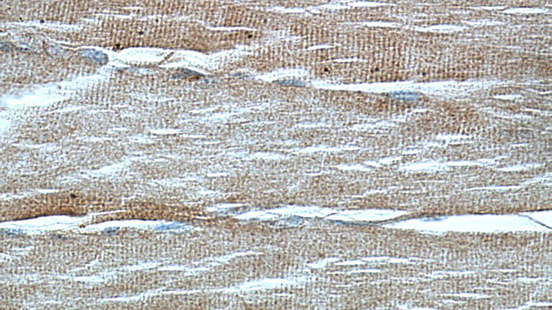 Immunohistochemistry of paraffin-embedded human skeletal muscle tissue slide using Catalog No:110149(DMD Antibody) at dilution of 1:100 (under 40x lens).