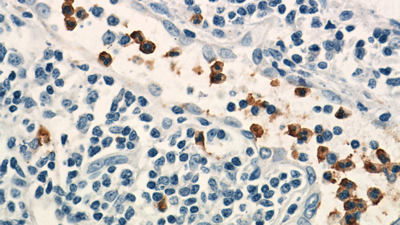Immunohistochemistry of paraffin-embedded human tonsillitis tissue slide using Catalog No:113316(NCF2 Antibody) at dilution of 1:50(under 40x lens)