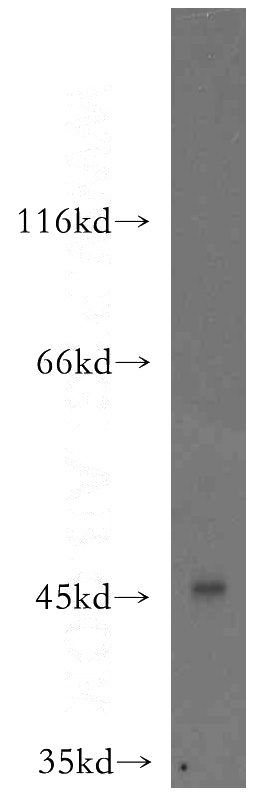 BxPC-3 cells were subjected to SDS PAGE followed by western blot with Catalog No:109733(C1QTNF4 antibody) at dilution of 1:1500