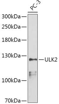 Western blot - ULK2 Polyclonal Antibody 