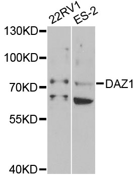 Western blot - DAZ1 Polyclonal Antibody 