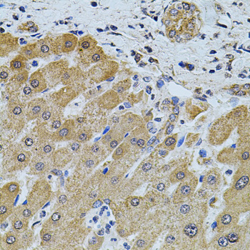 Immunohistochemistry - FoxO3a Polyclonal Antibody 