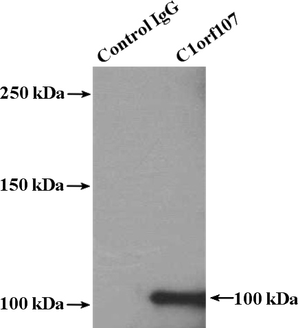 IP Result of anti-C1orf107 (IP:Catalog No:108632, 4ug; Detection:Catalog No:108632 1:300) with HepG2 cells lysate 1000ug.