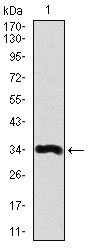 Fig1: Western blot analysis of Lipoprotein a on human Lipoprotein a recombinant protein using anti- Lipoprotein a antibody at 1/1,000 dilution.