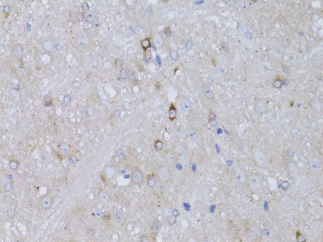 Immunohistochemistry - RARA Polyclonal Antibody 
