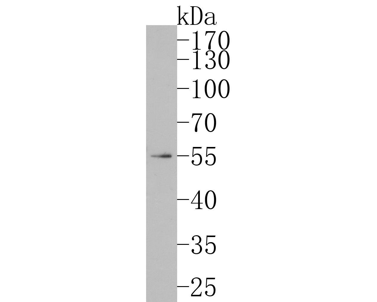 Fig1:; Western blot analysis of FAM13C on human brain tissue lysates. Proteins were transferred to a PVDF membrane and blocked with 5% NFDM/TBST for 1 hour at room temperature. The primary antibody ( 1/1,000) was used in 5% NFDM/TBST at room temperature for 2 hours. Goat Anti-Rabbit IgG - HRP Secondary Antibody (HA1001) at 1:200,000 dilution was used for 1 hour at room temperature.
