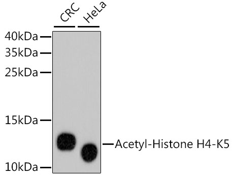 Western blot - Acetyl-Histone H4-K5 mAb 
