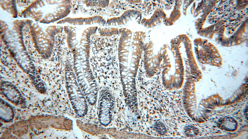 Immunohistochemical of paraffin-embedded human colon using Catalog No:108638(C11orf49 antibody) at dilution of 1:50 (under 10x lens)