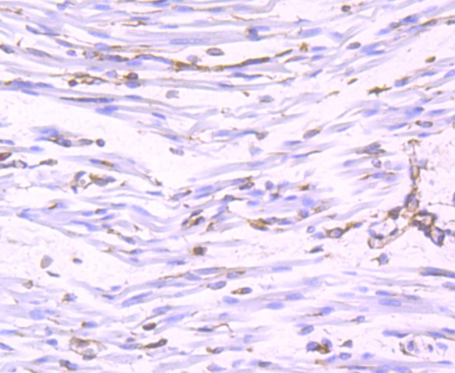 Fig7:; Immunohistochemical analysis of paraffin-embedded human fetal skeletal muscle tissue using anti-Nogo antibody. The section was pre-treated using heat mediated antigen retrieval with Tris-EDTA buffer (pH 9.0) for 20 minutes.The tissues were blocked in 1% BSA for 30 minutes at room temperature, washed with ddH; 2; O and PBS, and then probed with the primary antibody ( 1/50) for 30 minutes at room temperature. The detection was performed using an HRP conjugated compact polymer system. DAB was used as the chromogen. Tissues were counterstained with hematoxylin and mounted with DPX.