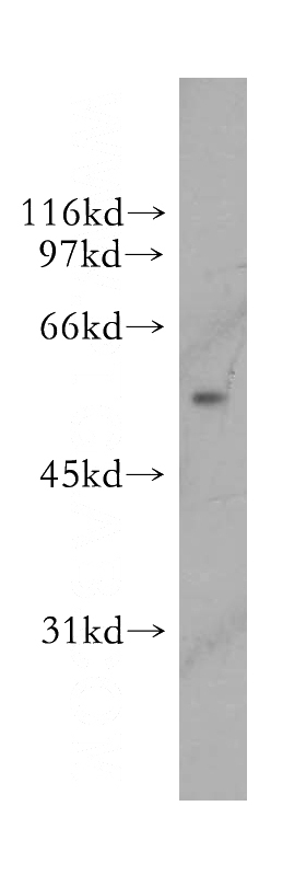 HepG2 cells were subjected to SDS PAGE followed by western blot with Catalog No:116556(UGDH antibody) at dilution of 1:500