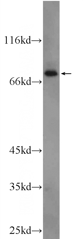 mouse heart tissue were subjected to SDS PAGE followed by western blot with Catalog No:109531(CPT1B Antibody) at dilution of 1:1000
