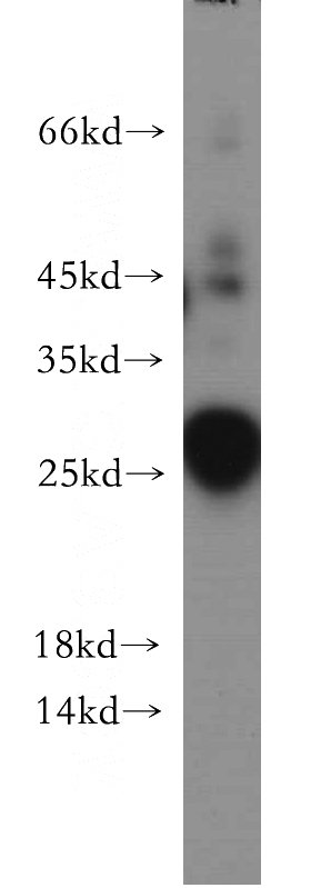 human testis tissue were subjected to SDS PAGE followed by western blot with Catalog No:110061(RP11-529I10.4 antibody) at dilution of 1:300