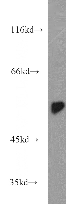 Jurkat cells were subjected to SDS PAGE followed by western blot with Catalog No:109867(DARS antibody) at dilution of 1:1000