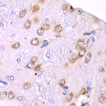 Immunohistochemistry - RPS3A Polyclonal Antibody 