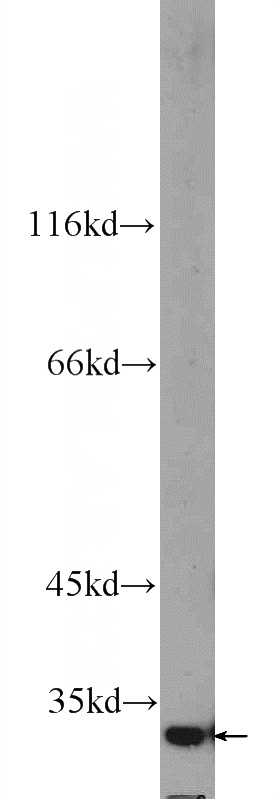 mouse liver tissue were subjected to SDS PAGE followed by western blot with Catalog No:110691(FOXB1 Antibody) at dilution of 1:300