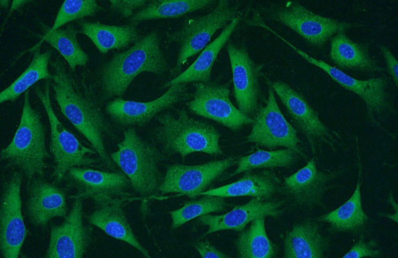 Immunofluorescent analysis of NIH/3T3 cells using Catalog No:108861(CARM1 Antibody) at dilution of 1:50 and Alexa Fluor 488-congugated AffiniPure Goat Anti-Rabbit IgG(H+L)