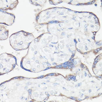 Immunohistochemistry - CLUH Polyclonal Antibody 