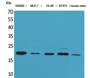 Fig1:; Western Blot analysis of SW480, MCF-7, HL-60, BT474, mouse colon cells using FGF-20 Polyclonal Antibody.. Secondary antibody（catalog#: HA1001) was diluted at 1:20000