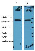 Western blot analysis of 1) Hela, 2) Mouse Brain, diluted at 1:2000.