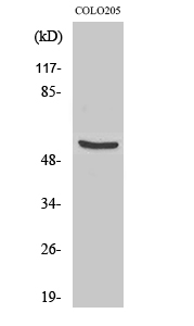 Fig1:; Western Blot analysis of various cells using TH Polyclonal Antibody