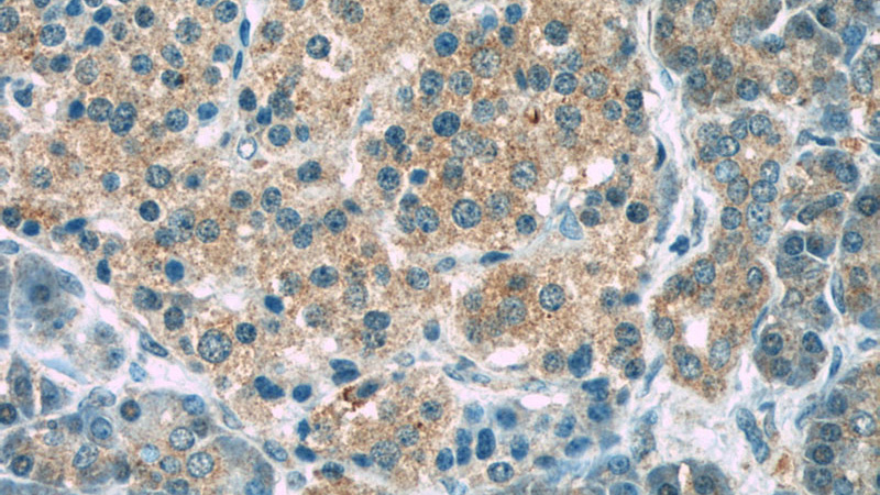 Immunohistochemistry of paraffin-embedded human pancreas slide using Catalog No:113717(EIF2AK3 Antibody) at dilution of 1:50
