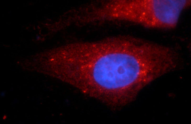 Immunofluorescent analysis of HepG2 cells using Catalog No:114006(PLOD3 Antibody) at dilution of 1:25 and Rhodamine-Goat anti-Rabbit IgG
