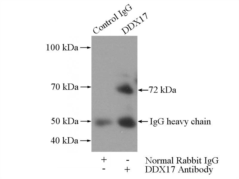IP Result of anti-DDX17,P72 (IP:Catalog No:109781, 4ug; Detection:Catalog No:109781 1:1000) with mouse brain tissue lysate 4000ug.
