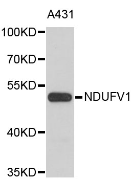 Western blot - NDUFV1 Polyclonal Antibody 